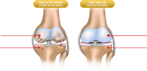 Viên dưỡng khớp Joint Max - Liệu trình 5 hộp 1 Viên dưỡng khớp Joint Max - Liệu trình 5 hộp 1
