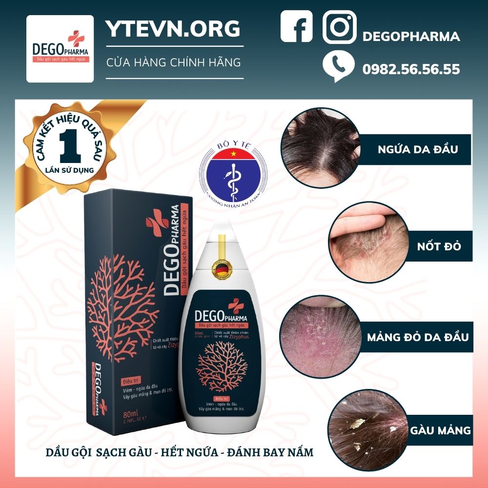 Dego Pharma - Dầu gội sạch vảy gàu mảng trắng, hết ngứa chiết xuất thiên nhiên từ vỏ cây Zizyphus, sản xuất theo tiêu chuẩn và dưới sự giám sát của công ty dược phẩm Châu Âu (80ml)