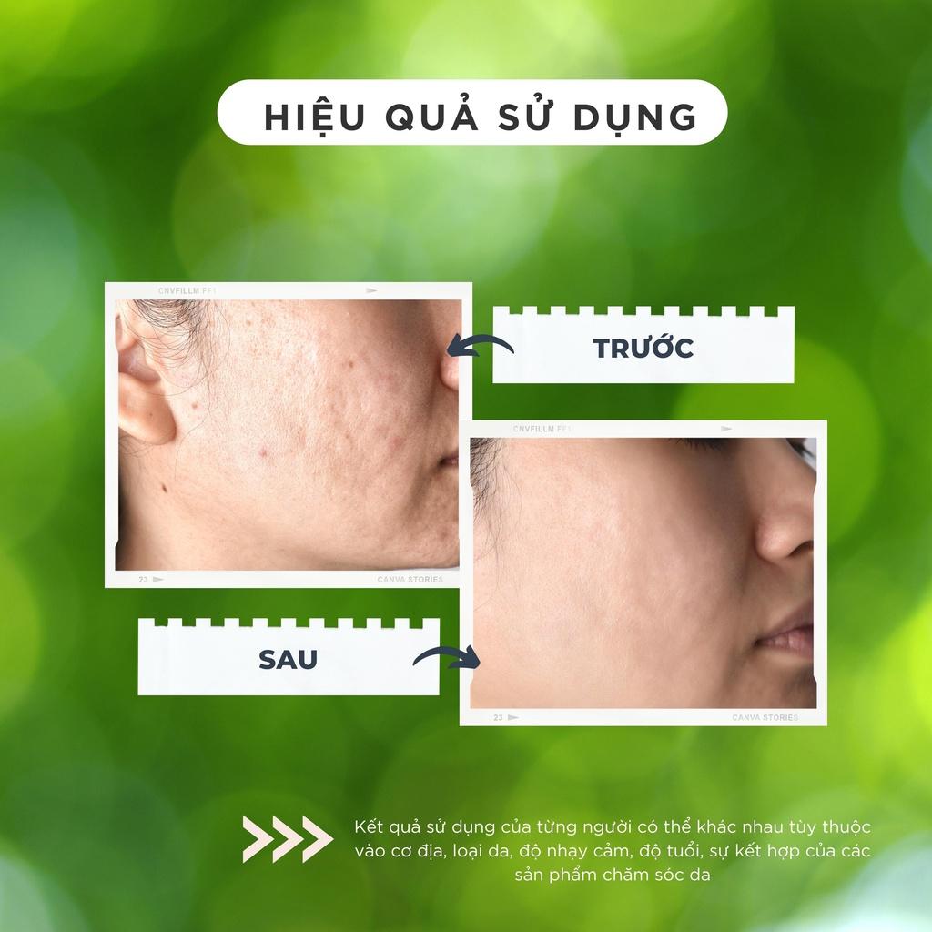 KEM DƯỠNG TRẮNG DA COLLAGEN CHAMIS THU NHỎ LỖ CHÂN LÔNG
