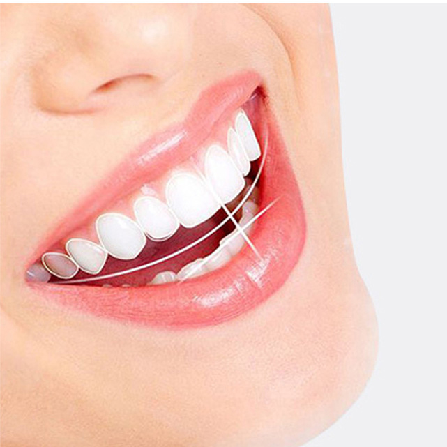 Kem đánh răng Ora2 Stripe Paste Nhật Bản 140g, Thơm miệng, ngừa sâu răng