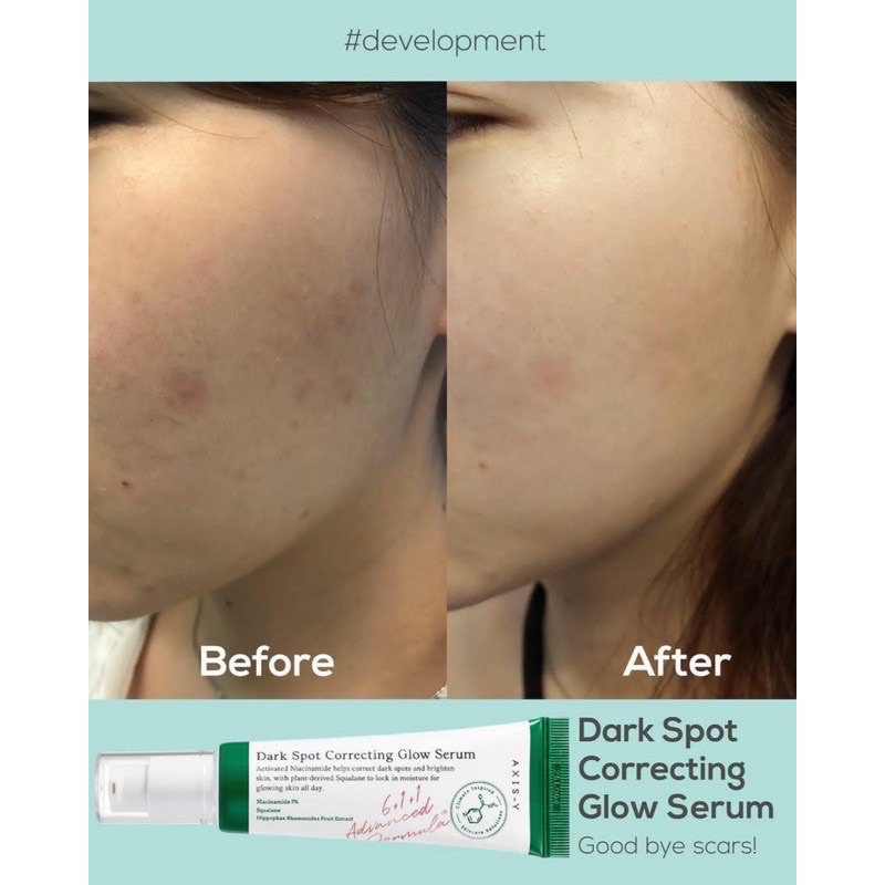 Tinh Chất 5% Niacinamide Cải Thiện Da Không Đều Màu, Mờ Thâm Axis-Y Dark Spot Correcting Glow Serum 50ml