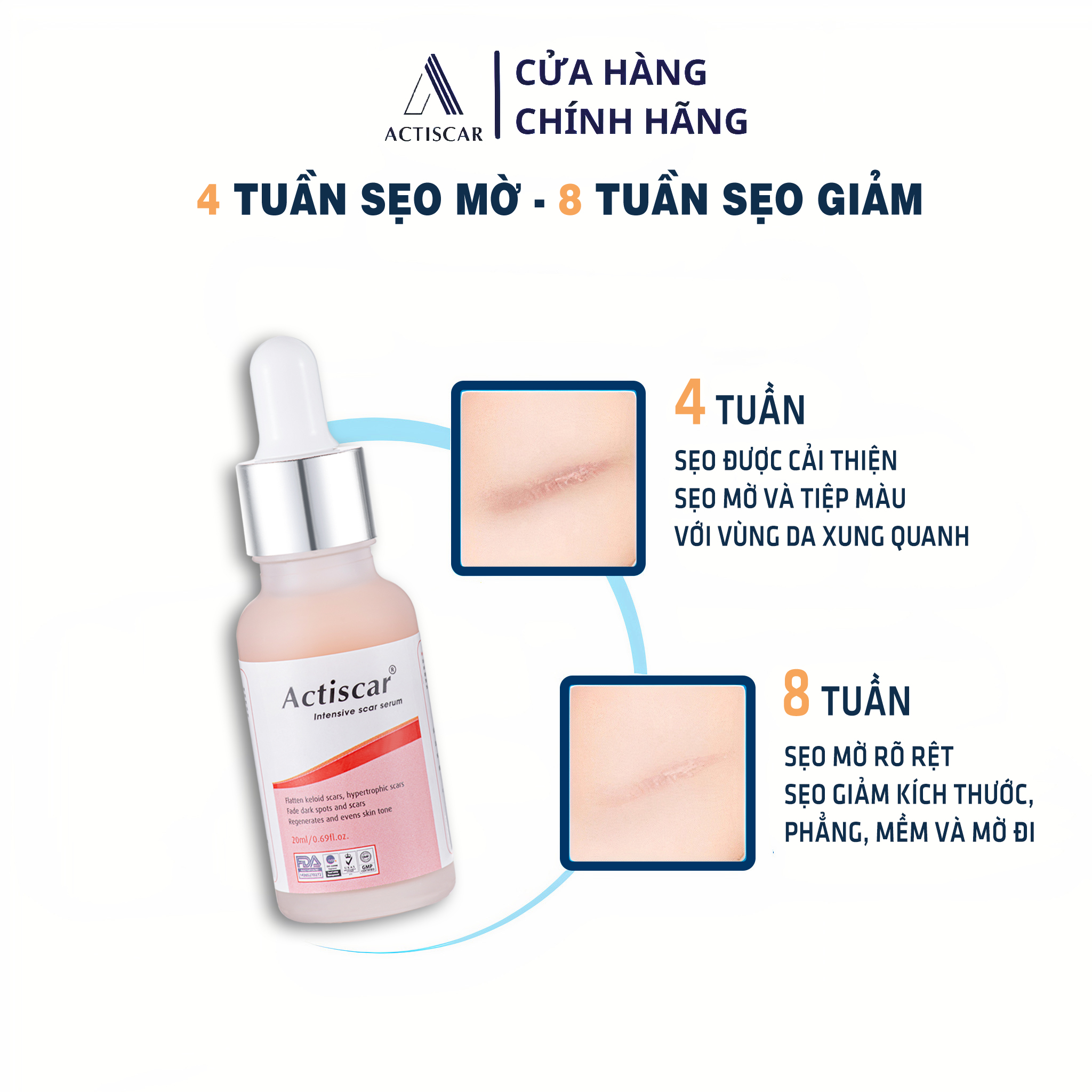 Serum Xóa Sẹo Lồi, Sẹo Phì Đại Actiscar 20ml