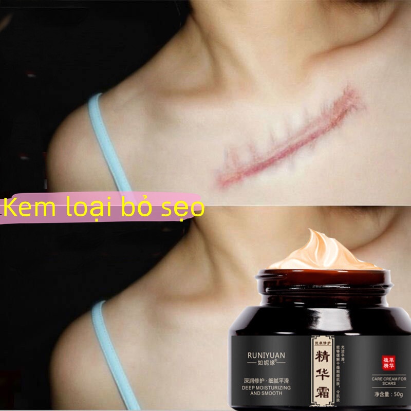 Kem xoá mờ sẹo 50g xóa sẹo thâm lồi, lõm, bỏng, thủy đậu, rạn da sau sinh , vết thâm mặt cải thiện làn da sáng mịn