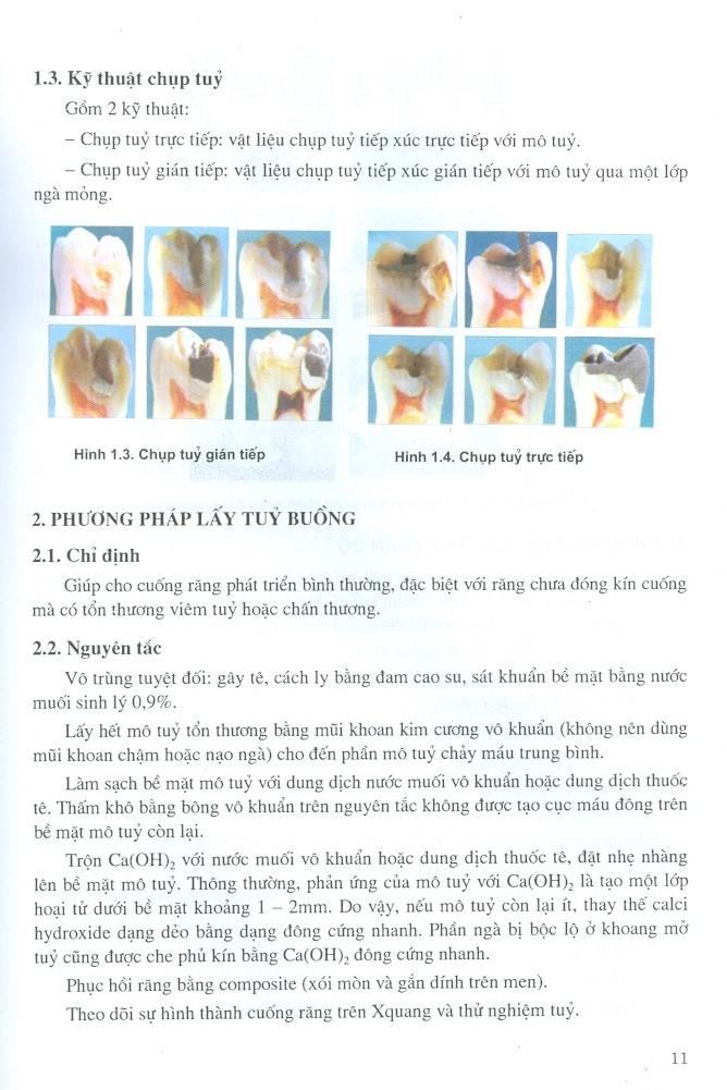 Chữa Răng Và Nội Nha - Tập 2 - Nội Nha Lâm Sàng