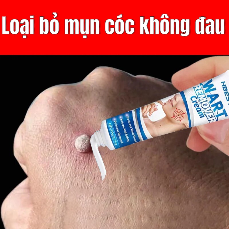 (Loại tốt) Kem tẩy xóa bỏ mụn cóc mụn thịt nốt ruồi trên da hiệu quả cao từ thảo dược thiên nhiên không gây sẹo