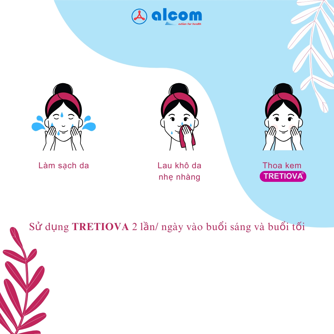 Kem Tretiova Tube 30g Hỗ Trợ Dưỡng Trắng Da