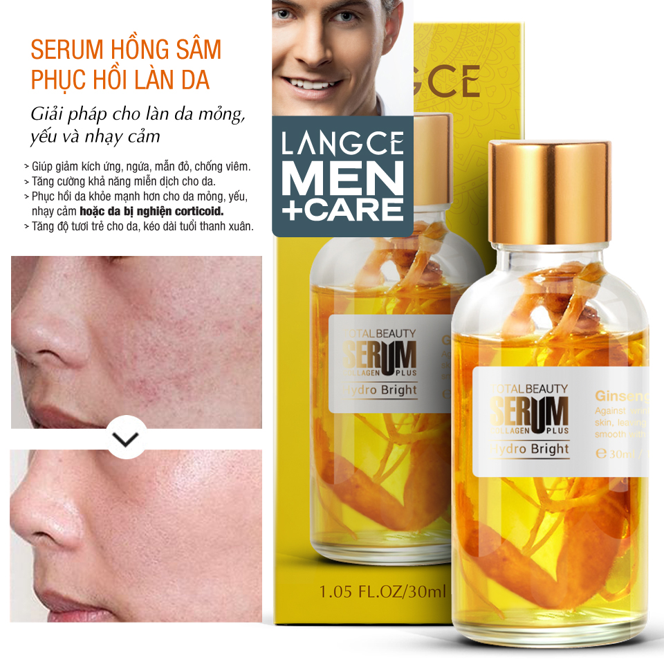 SERUM SÂM GIẢM MẪN ĐỎ, CHỐNG VIÊM TĂNG CƯỜNG KHẢ NĂNG MIỄN DỊCH CHO DA 30ml LANGCE dành cho Nam