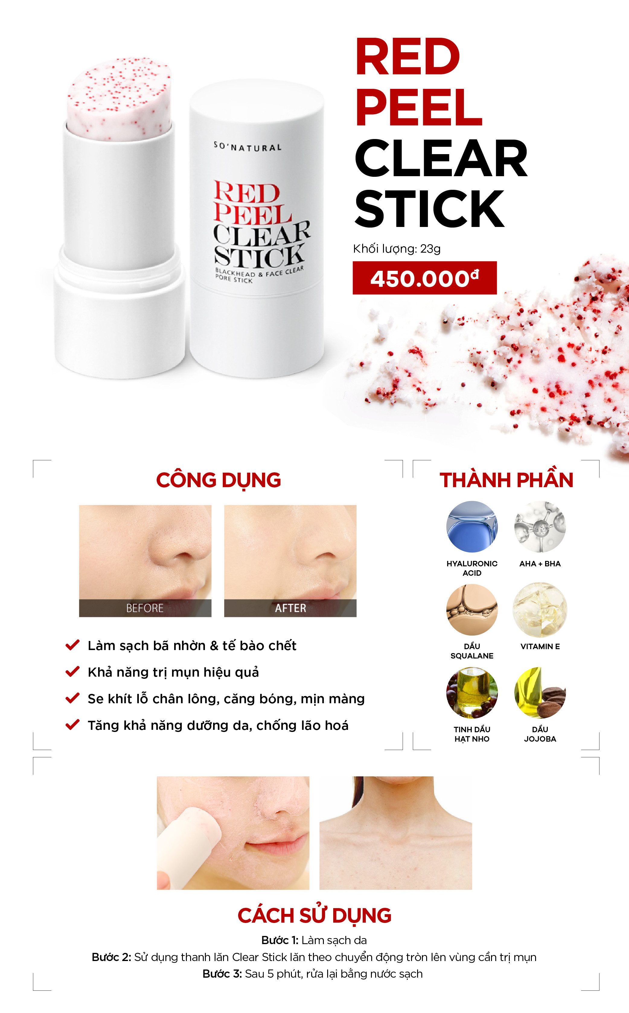 Red Peel Clear Stick Chính Hãng So Natural Pore Blackhead &amp; Face Thanh Lăn Mụn Đầu Đen 23gram