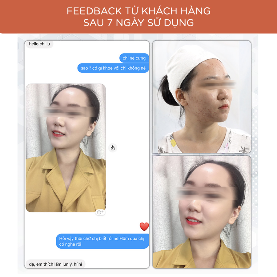 KEM MISSFAIRY LINH CHI 15g - NGĂN NGỪA MỤN - GIẢM THÂM