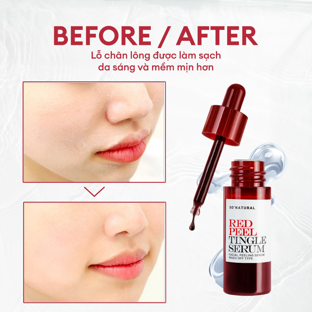 Tinh Chất Red Peel Tingle Serum 11ML