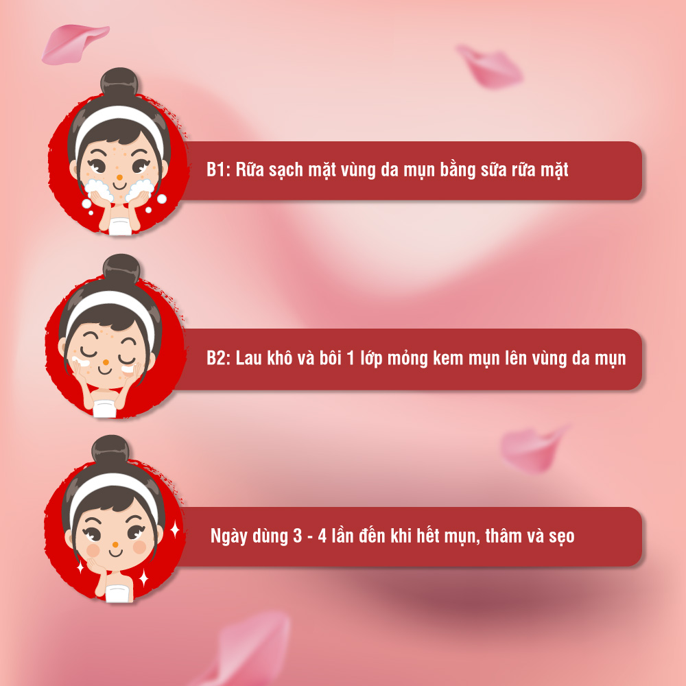 Kem Hỗ Trợ Giảm Mụn Đầu Đen Cho Da Nhờn Acnevir đỏ