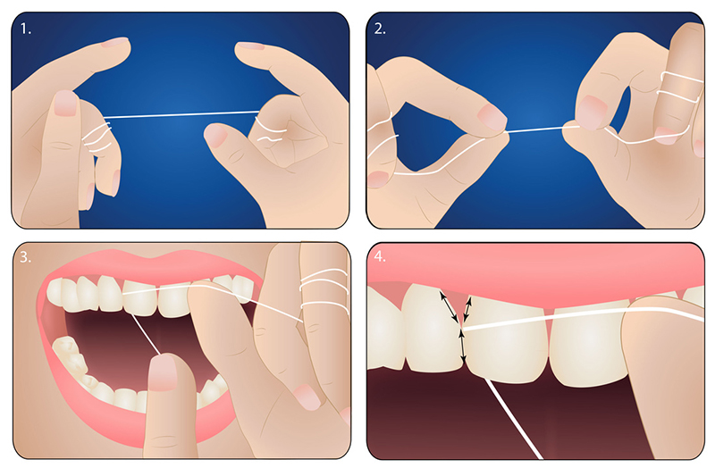 Chỉ nha khoa hương Bạc hà Pierrot 50m - cho răng thưa