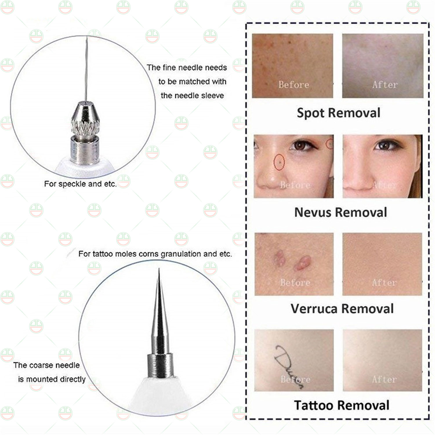 Bút Xóa Đốt Nút Ruồi KhoNCC Hàng Chính Hãng - Tàn Nhang - Mụn Cóc - Thịt Dư - Có Đèn Led Hiển Thị Tự Làm Đẹp Hiệu Quả Một Cách Bất Ngờ - KLVQ-324-BXTN