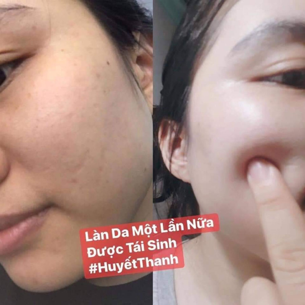 [CAM KẾT CHÍNH HÃNG] Huyết Thanh Trắng Da 7 Day - OLIC (Serum 7 DAY - OLIC) giúp TRẮNG DA, NÂNG CƠ, TRẺ HÓA DA, trẻ ra từ 5~10 tuổi.