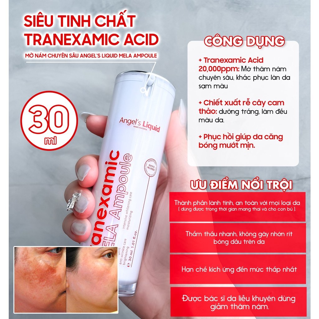 Siêu Tinh Chất Xoá Thâm Đỏ Mờ Sạm Nám Angel's Liquid Tranexamic Mela Ampoule 30ml