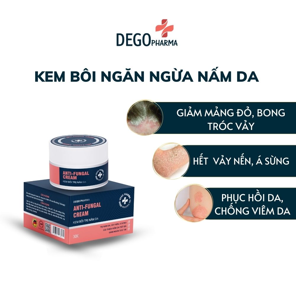 Kem bôi dứt điểm nấm da đầu, vảy nến, á sừng, eczema Dego Pharma 