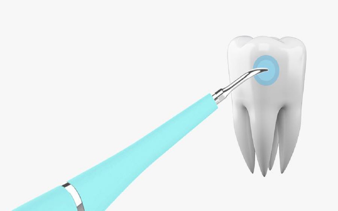 Máy Lấy Cao Răng Cầm Tay Mini Sử Dụng Sạc 3 Chế Độ Rung Loại Sạch Mảng Bám, Cao Răng,Vết Ố Cứng Đầu Nhất