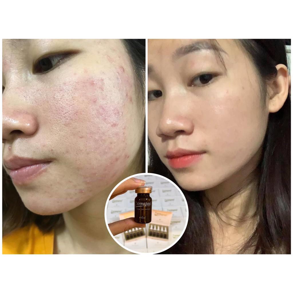 Vi kim tảo biển trứng cá tuyết Derma peel+ Skincare Total Solution - Vì Làn Da Hoàn Hảo