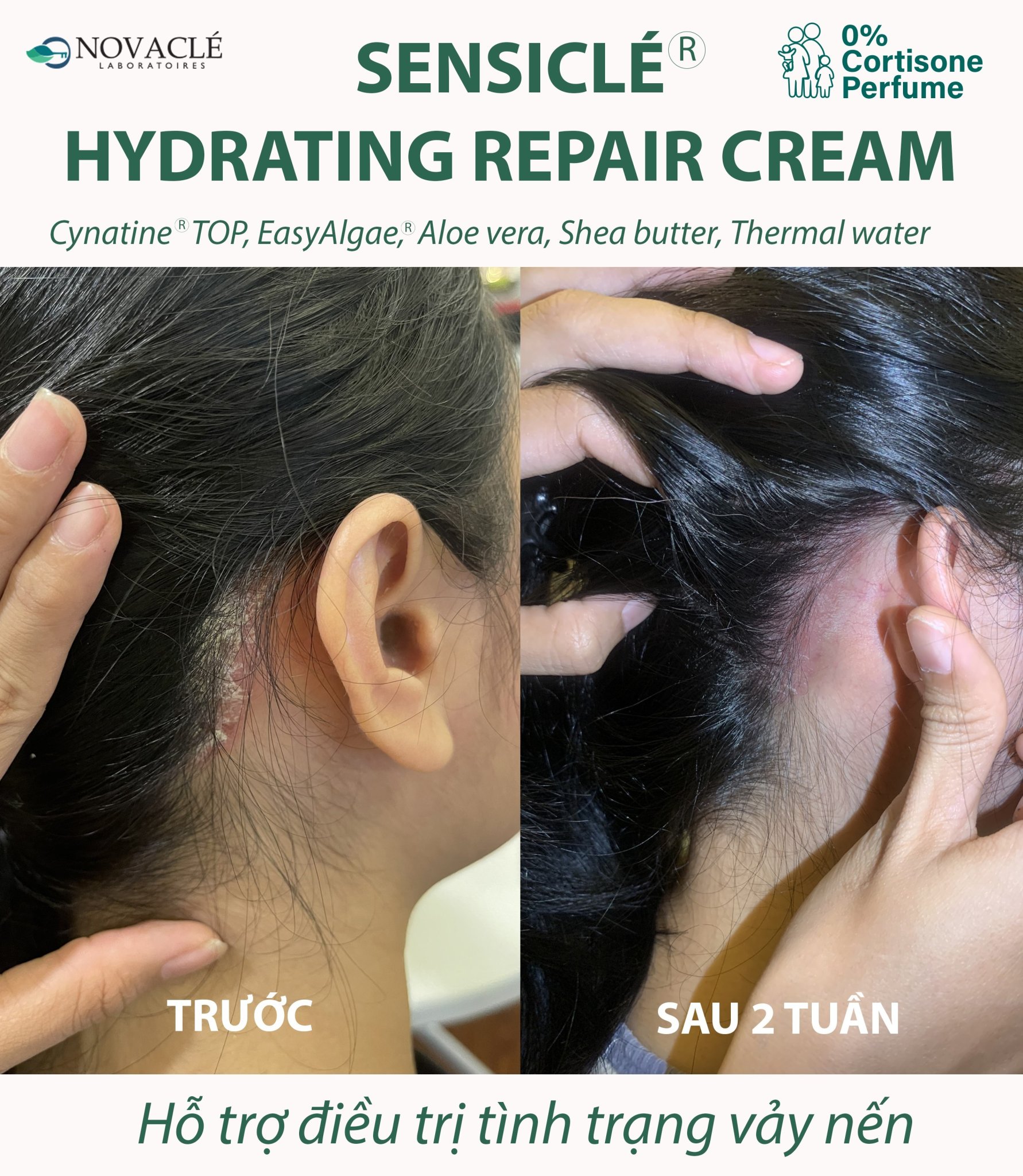 Kem Dưỡng Ẩm Cho Mọi Loại Da Sensiclé - Crème Réparatrice Hydratante