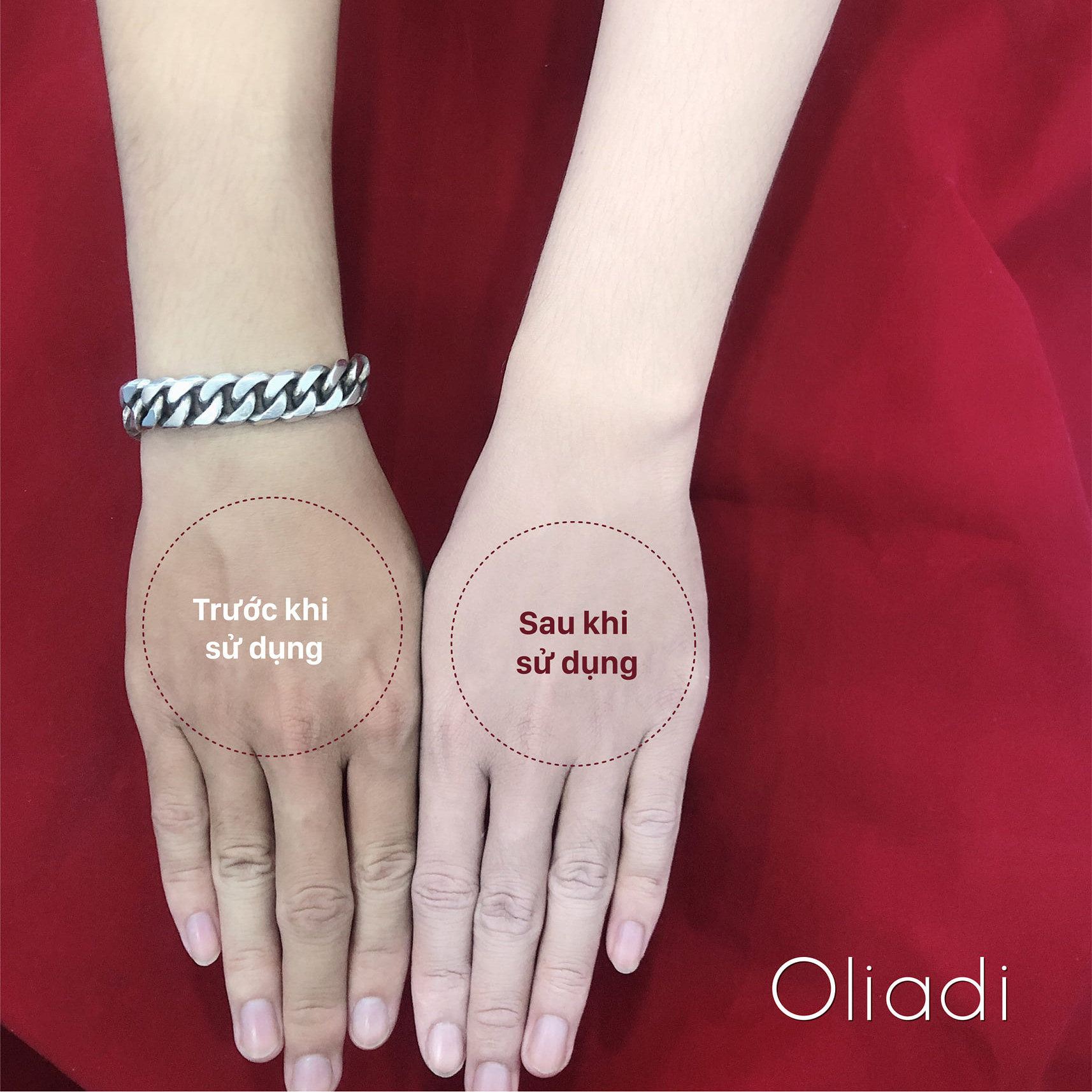 Kem Body Nano Phân Tử Oliadi - [ Gigawhite + Veryberywhite ]