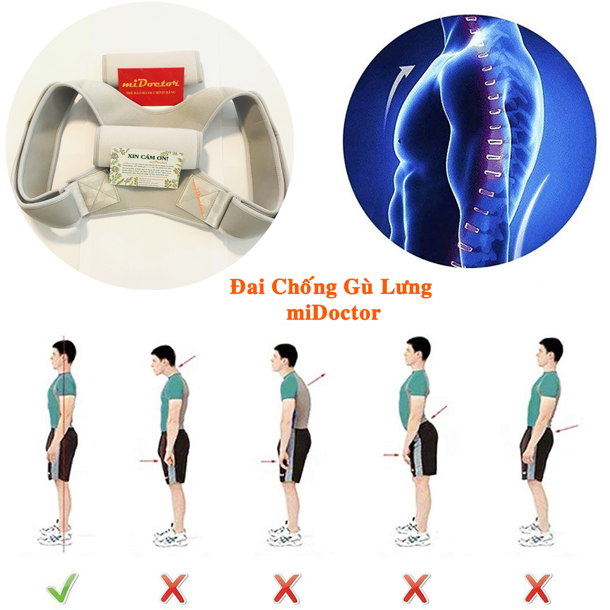 Đai Chống Gù Lưng Cho Trẻ Em Cao Cấp Chính Hãng miDoctor – Đai Lưng Chống Gù Trẻ Em (Từ 5 – 13 Tuổi) - mi03TR