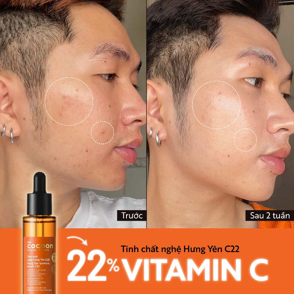 Tinh chất nghệ Hưng Yên C22 với 22% vitamin C sáng da chuyên sâu &amp; mờ vết thâm Cocoon 30ml