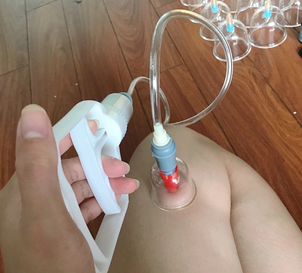 Bộ Giác Hơi Không Dùng Lửa 32/24 Món Cao Cấp, Thiết Bị Giác Hơi Chân Không, Cạo Gió Giác Hơi