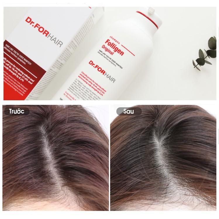 Combo gội xả dưỡng hỗ trợ mọc tóc giảm rụng tóc và gàu Dr.FORHAIR Plus Shampoo 500ml x Scalp Pack 250ml