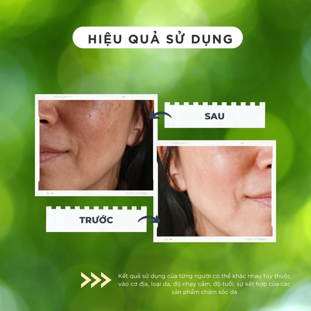 Kem Dưỡng & Serum giảm mờ thâm nám, dưỡng da trắng hồng Topcharm hàng cao cấp