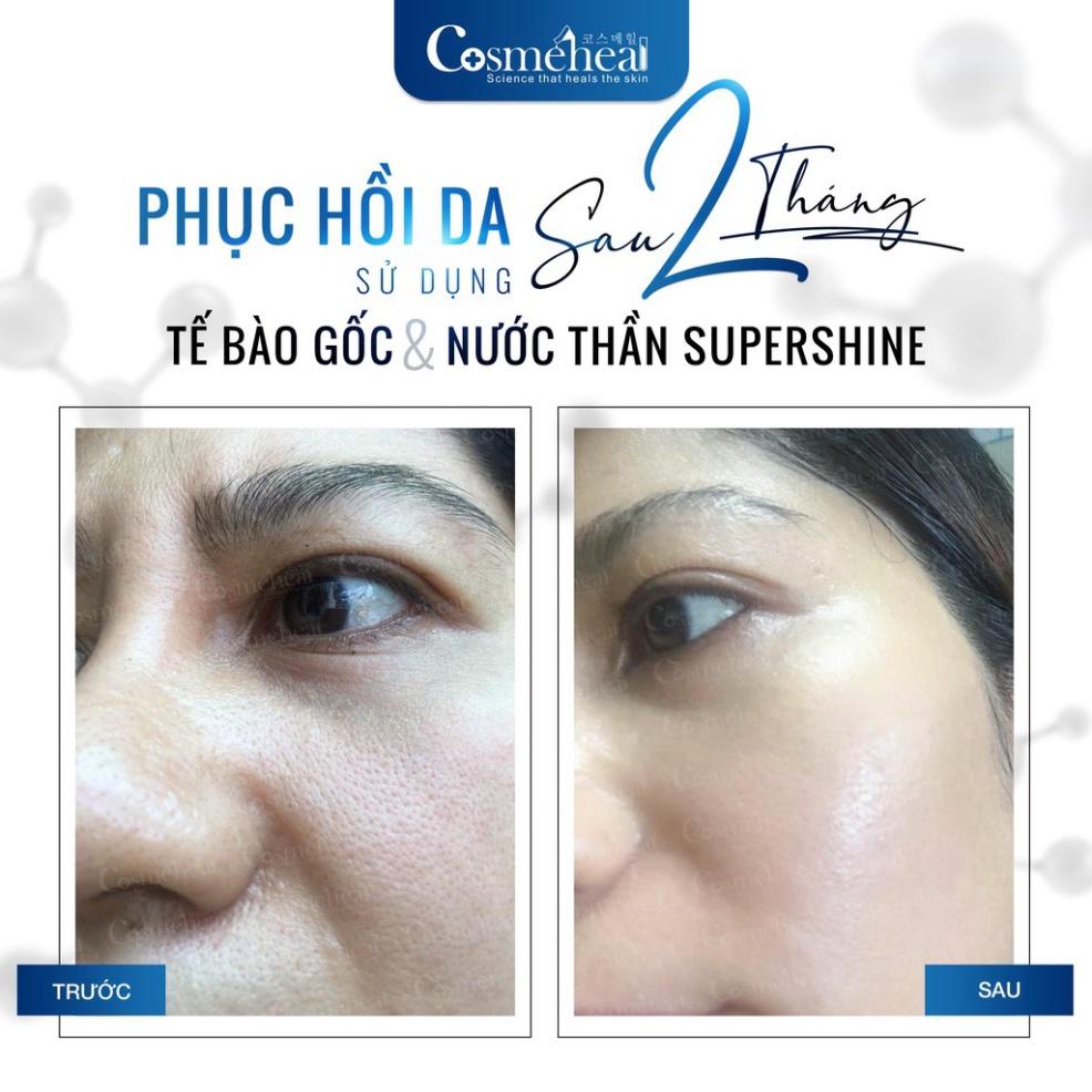 Tế bào gốc căng bóng da COSMEHEAL SuperShine Ampoule