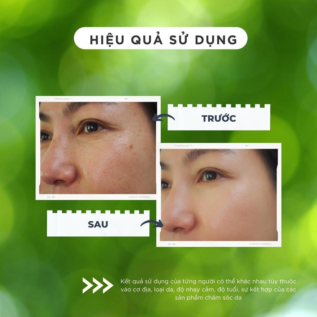 Serum Dưỡng trắng Trẻ hóa da Topcharm