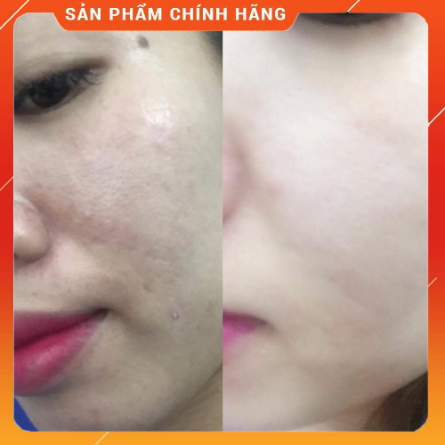 Kem Nền Làm Sáng Bừng Làn Da Gấp 3 Lần Edally Ex Brightening Triple BB Cream SPF41Pa+++