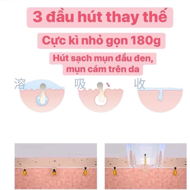 Máy Hút Mụn Đa Năng Trang Bị 3 Đầu Hút, Hút Sạch Mụn Cám, Mụn Đầu Đen Và Sợi Bã Nhờn Giúp Bảo Vệ Da Và Hạn Chế Tối Đa Các Tổn Thương Khi Lấy Mụn.
