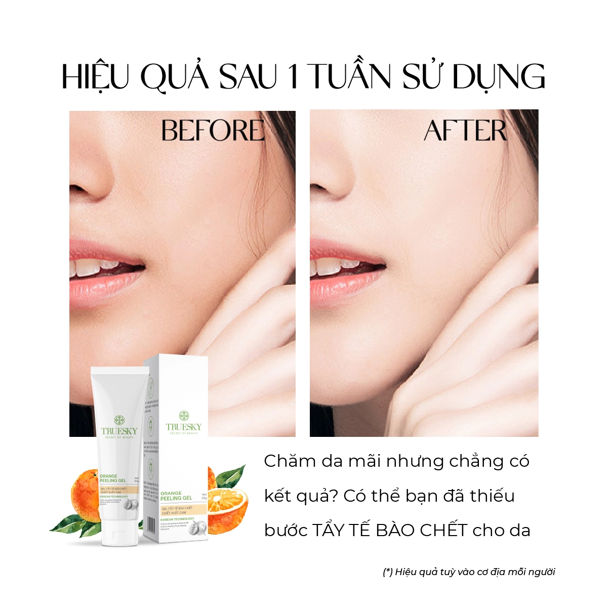 Gel tẩy da chết Truesky Orange Peeling 50g chiết xuất cam