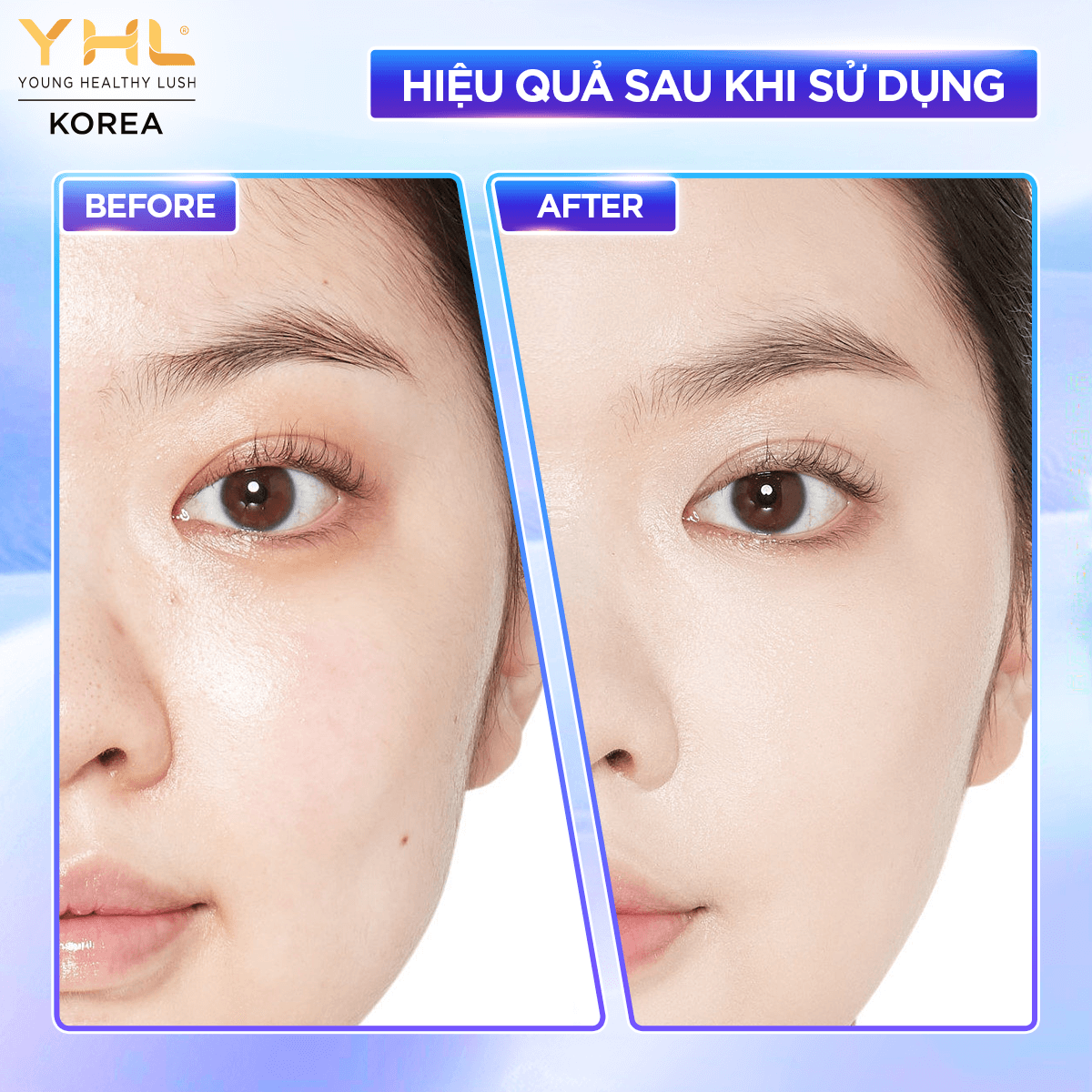 Tinh chất nâng cơ YHL 30ml Hàn Quốc