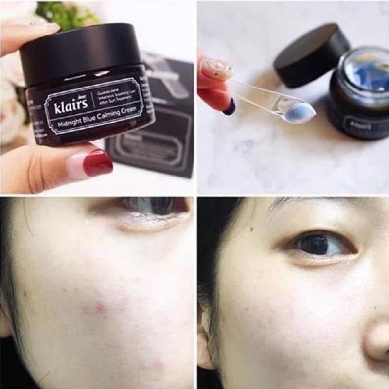 Kem Dưỡng Ẩm, Làm Dịu Và Phục Hồi Da Ban Đêm Dear Klairs Midnight Blue Calming Cream 30ml/60ml