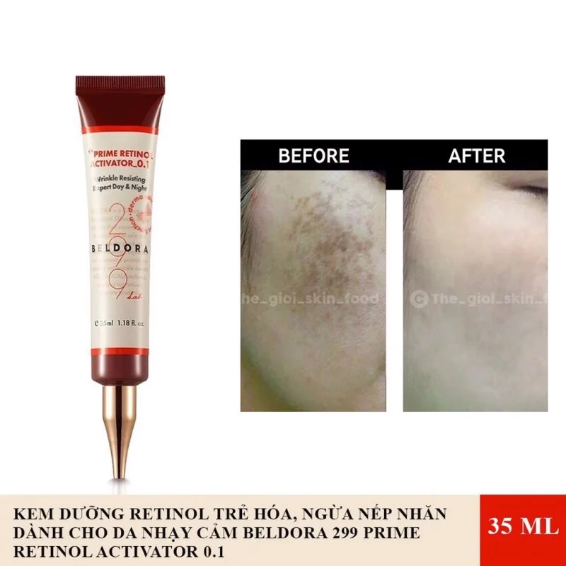 Kem Dưỡng Retinol Trẻ Hóa Da, Giảm Nếp Nhăn Và Ngăn Mụn Beldora 299 Prime Retinol Activator 35ml