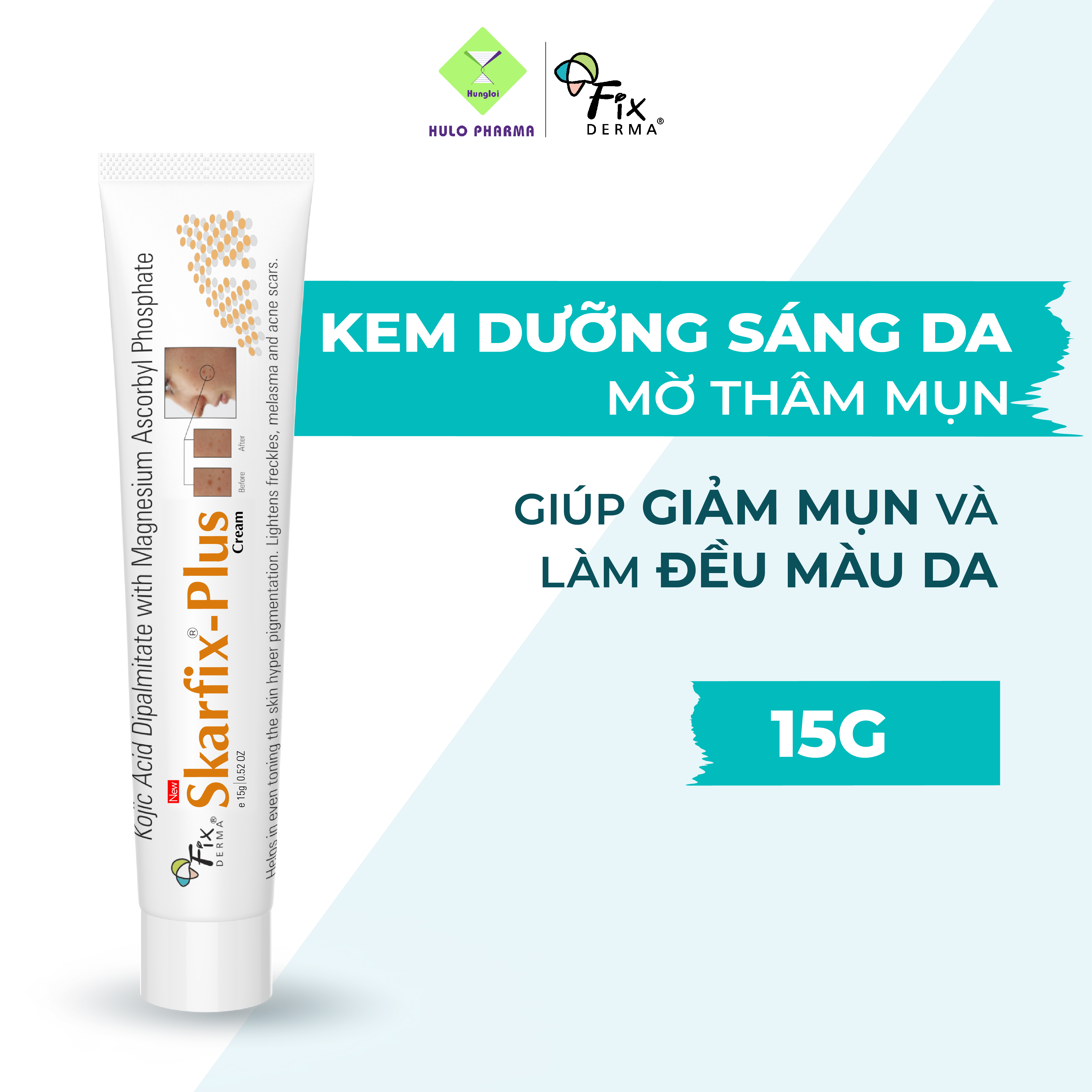 Kem sáng da Fixderma Skarfix Plus Cream (15g)