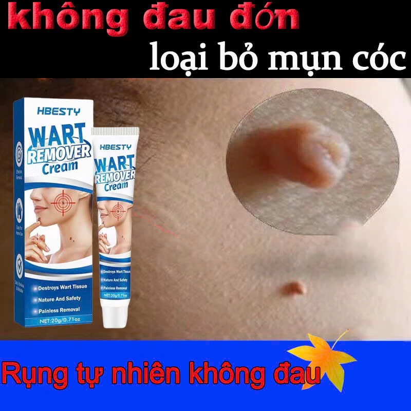Serum Xóa Mụn Cóc, Mụn Thịt, Nốt Ruồi Hiệu Quả Cao – Thảo Dược Thiên Nhiên, Không Gây Sẹo đèn led