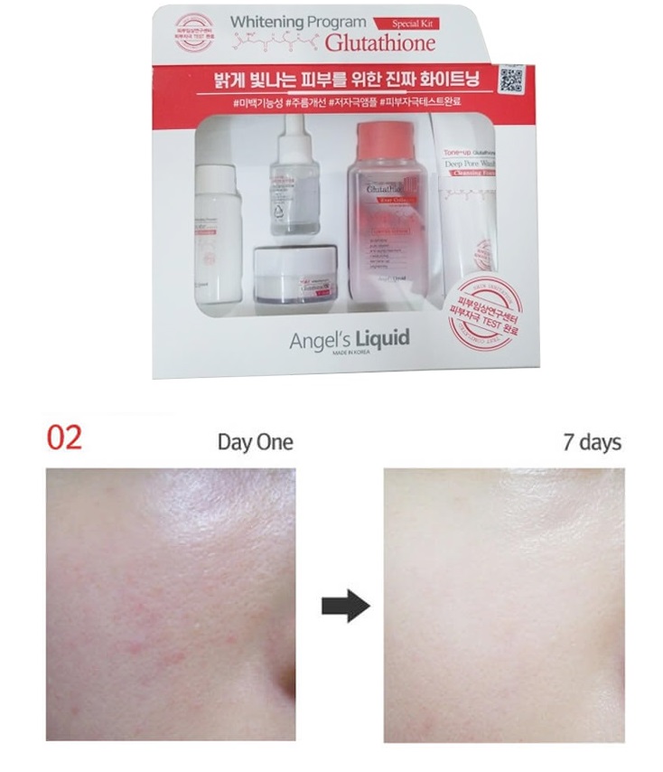 Bộ kit 5 món Dưỡng Trắng Da, Làm Mờ Thâm Angel's Liquid Whitening Program Special Kit Glutathione