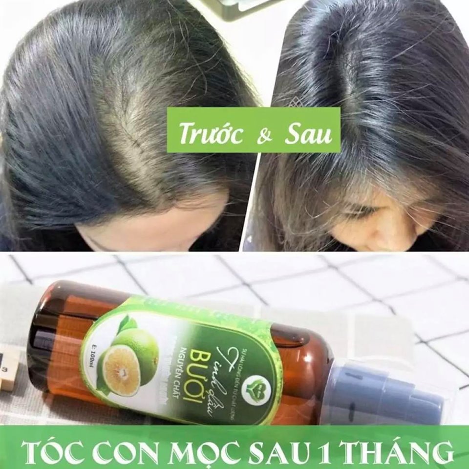 TINH DẦU BƯỞI NGUYÊN CHẤT MẸ KEN- 100ML