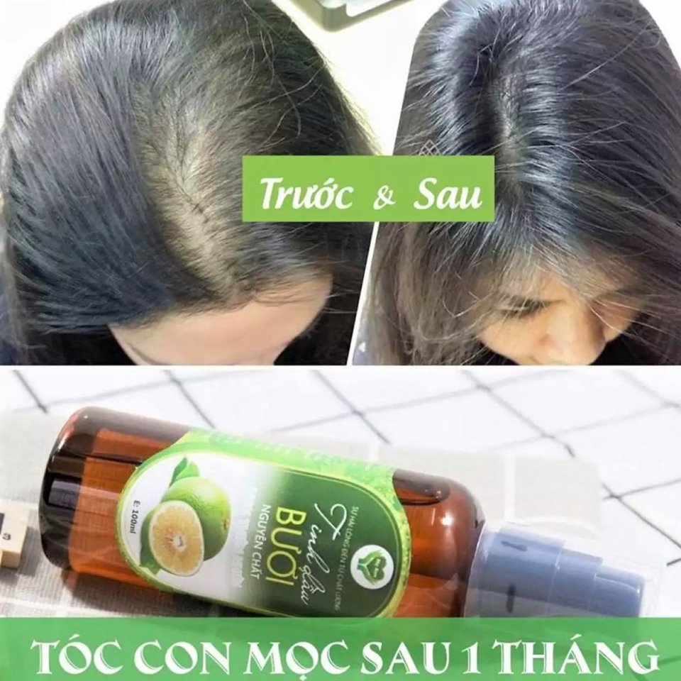 TINH DẦU BƯỞI NGUYÊN CHẤT MẸ KEN- (Kích thích mọc tóc, giảm rụng tóc, suôn mượt) 100ML