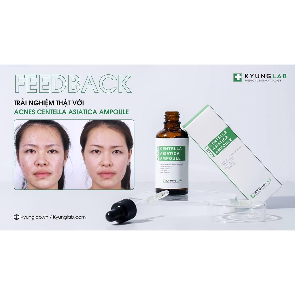 HÀNG NHẬP KHẨU - Serum Kyung Lab Acnes Centella Asiatica Ampoule giảm mụn kiềm dầu mờ thâm KyungLab 50ml