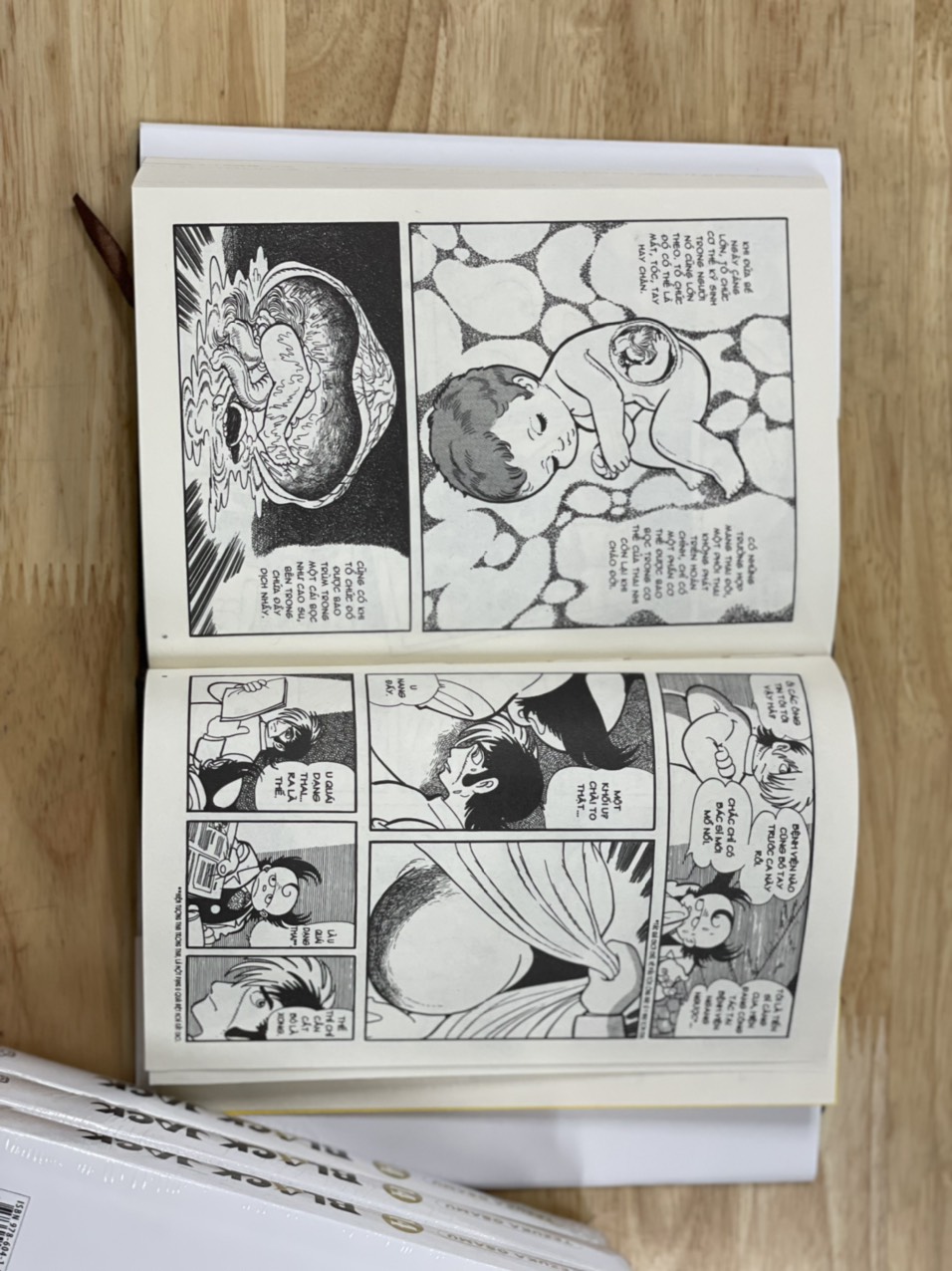 BLACK JACK từ tập 1 tới tập 14 - Tezuka Osamu - Bình Book