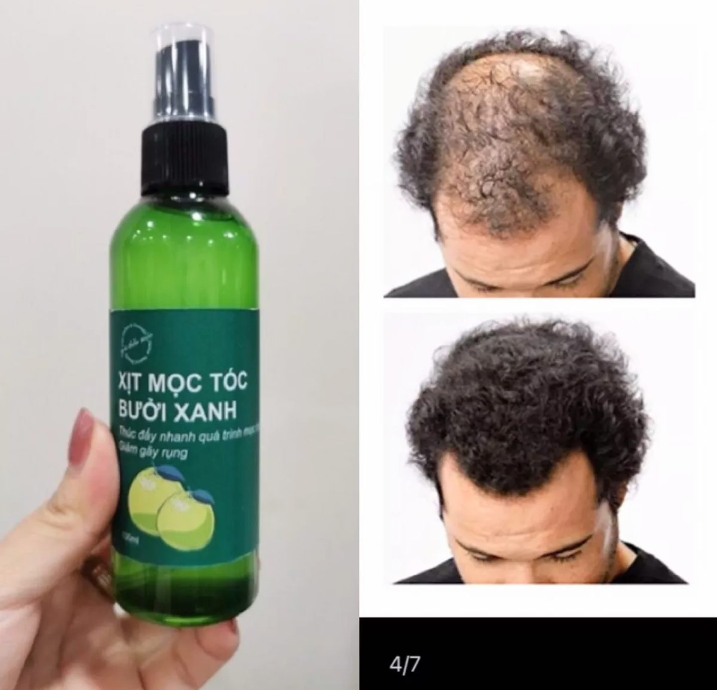SIÊU GIÁ VỚI 1 CHAI TINH DẦU BƯỞI XANH KÍCH THÍCH MỘC TÓC DƯỠNG CHĂM SÓC TÓC HIỆU QUẢ HÀNG CAO CẤP