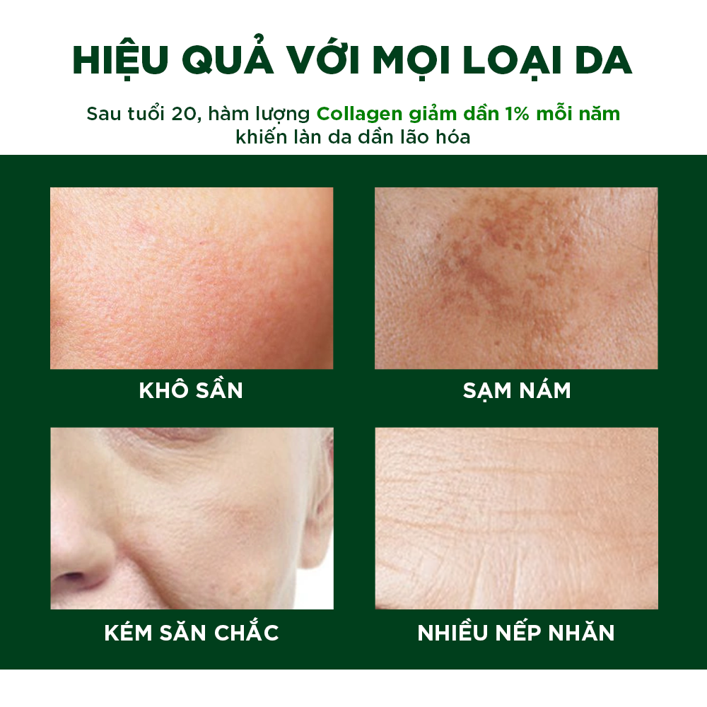 Combo 3 Viên Uống Đẹp Da Chống Nám Ngăn Ngừa Lão Hóa Oribe (Hộp 30 viên)