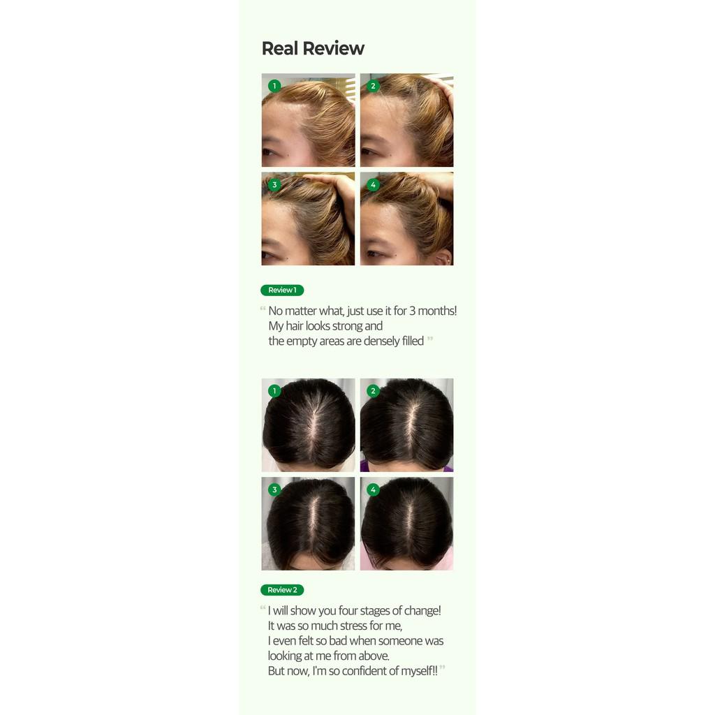Dầu Xả ngăn ngừa rụng tóc Some By Mi Cica Peptide Anti-Hair Loss Derma Scalp TREATMENT 50ml