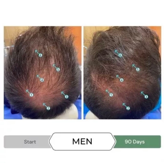 Dầu xả chống oxy hóa, kích thích mọc tóc REVITA.CBD CONDITIONER  205ML