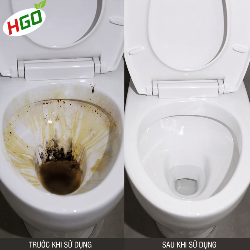 Nước tẩy bồn cầu HGO TOILET gel đậm đặc, tẩy sạch, khử mùi hôi, diệt 99,99% vi khuẩn, an toàn với men sứ 960ml