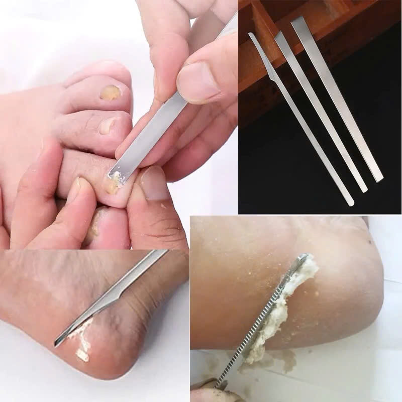 Bộ 3 Dao Lấy Khóe Móng Nhặt Da Khóe, Cắt Móng Gãy, Cạo Da Chai Sần, Loại Bỏ Da Chai Sần Ở Lòng Bàn Chân